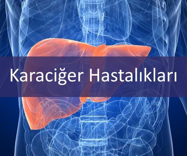 karaciğer hastalıkları resim